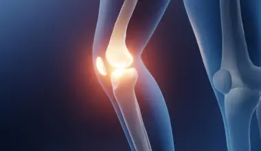 Scientists reveal the best exercise to ease knee arthritis pain