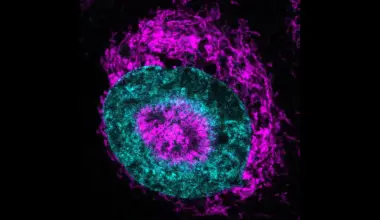 Scientists just found cancer cells’ hidden power source