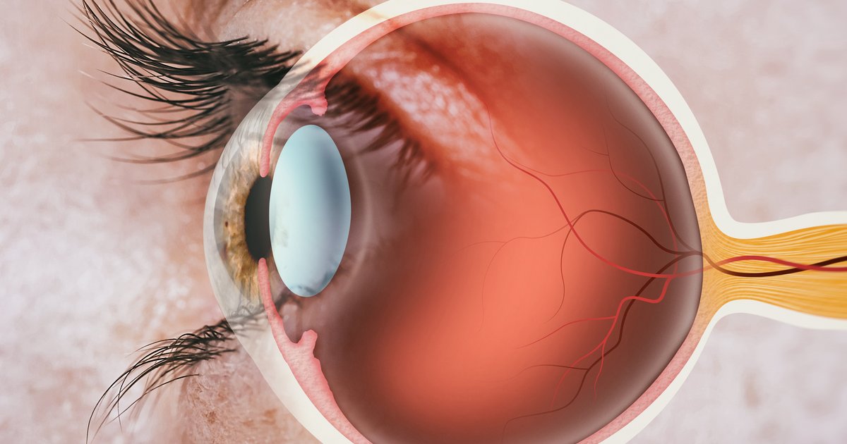 Genetic cause of hereditary vision loss discovered