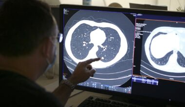 These medications could save thousands of lives – but doctors aren’t prescribing them