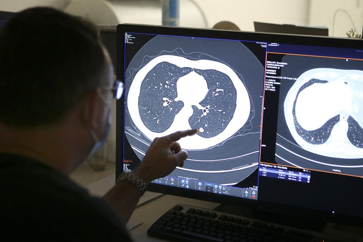 These medications could save thousands of lives – but doctors aren’t prescribing them