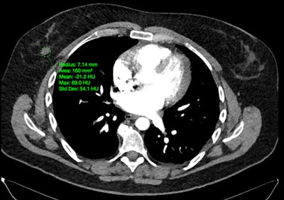 Protect Her utilizes AI-based analysis of routine imaging scans to detect early signs of breast cancer, cardiovascular disease, and osteoporosis.