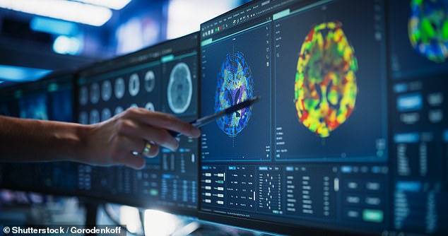 CT head scans are commonly prescribed medical tests used to diagnose neurological issues like head trauma and stroke (stock)