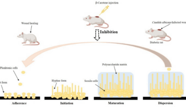 The dual antifungal and antibiofilm activities of β-carotene against multidrug-resistant Candida albicans induce wound healing in a diabetic rat model: an in vitro and in vivo study | BMC Microbiology