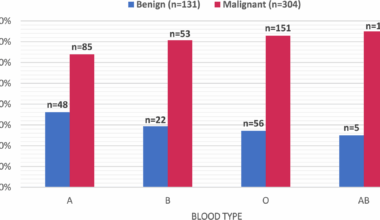 ABO blood types can play a role in determining the aggressiveness of thyroid cancer in adult patients: a single-centre retrospective study | BMC Endocrine Disorders