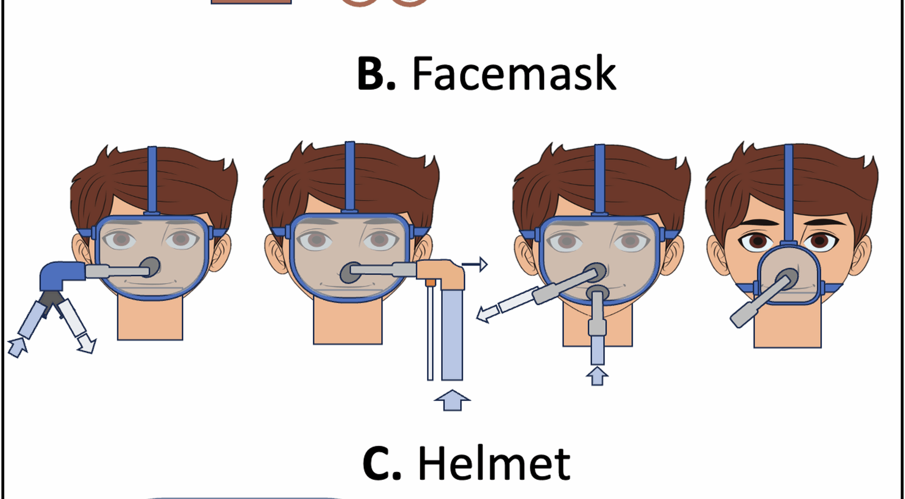 A clinical guide to non-invasive respiratory support in acute respiratory failure: ventilation settings, technical optimization and clinical indications | Critical Care