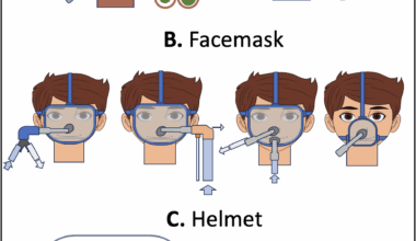 A clinical guide to non-invasive respiratory support in acute respiratory failure: ventilation settings, technical optimization and clinical indications | Critical Care
