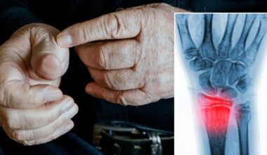 Osteoporosis alert issued over popular medication as doctor warns 'they're not good for bones'