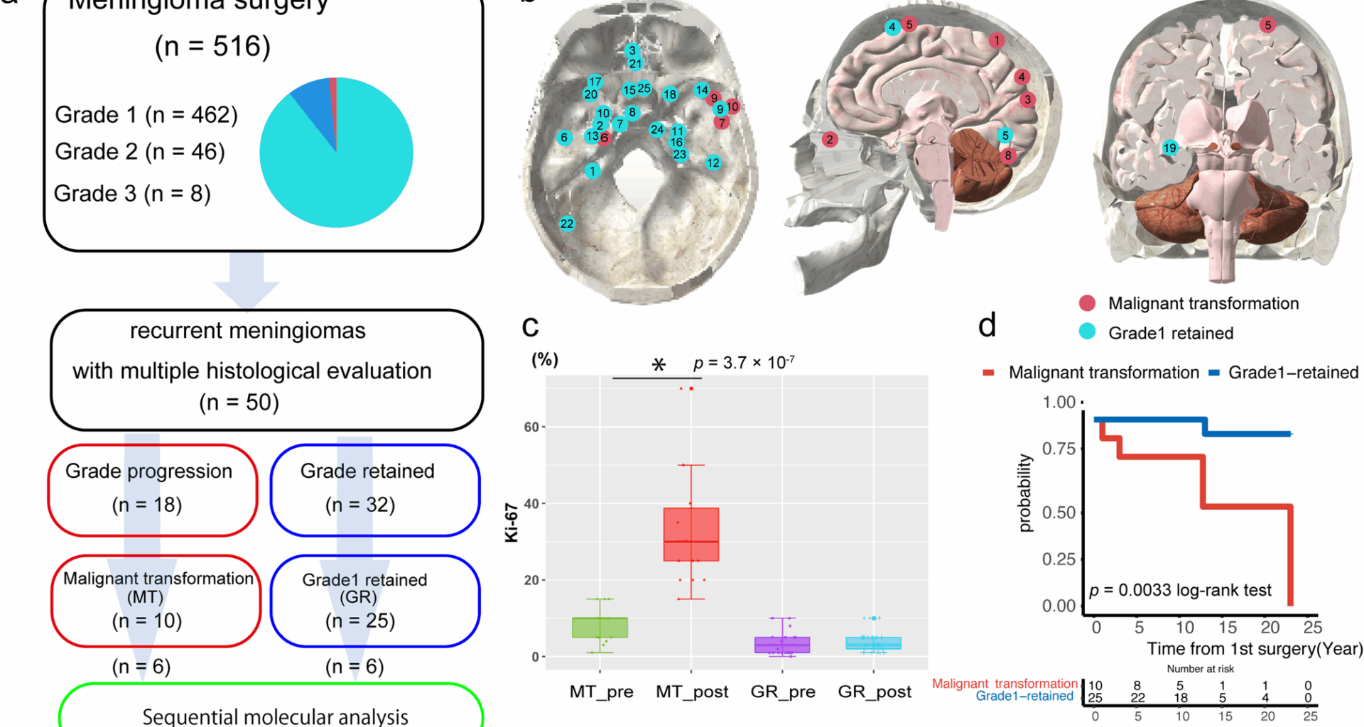 Sequential omics analysis reveals molecular signatures of malignant transformation in recurrent meningiomas | Acta Neuropathologica Communications