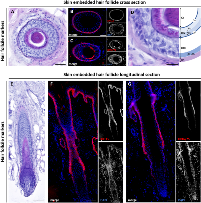 Ex vivo detection of SARS CoV 2 spike protein in human hair follicles and potential link to telogen effluvium