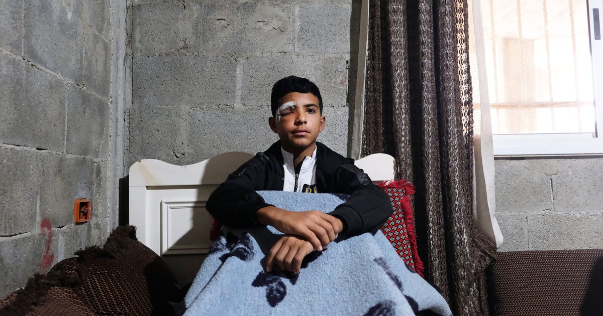 A Palestinian Boy Waited for His School Bus. An Israeli Soldier Fired a Tear-gas Canister in His Face