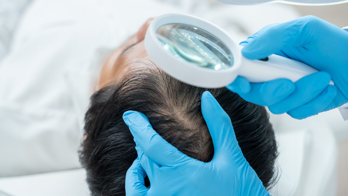 Is biotin good for growing hair? Experts on supplement's benefits