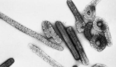 Marburg virus disease confirmed in Ethiopia amid regional instability