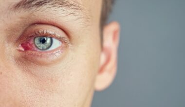 OA says the indiscriminate use of device-based dry eye therapies pose a “significant risk to patient safety". Image: lenbir/stock.adobe.com.