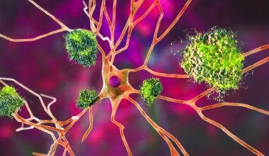 Study: Oral administration of arginine suppresses Aβ pathology in animal models of Alzheimer