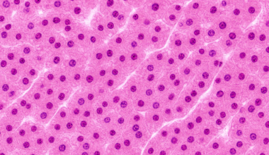 NewLimit 'close' to clinic-ready epigenetic reprogramming therapy