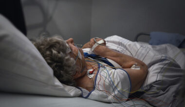 obstructive sleep apnea in older adults