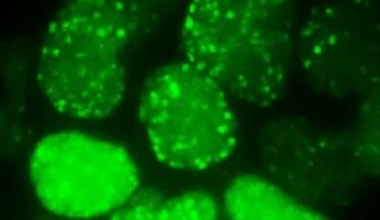 Brighter Side of News