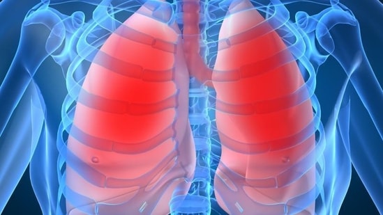 Coil implantation could be an alternative to major lung-reduction surgery for patients with emphysema, a form of chronic obstructive pulmonary disease, or COPD.(Adobe Stock)