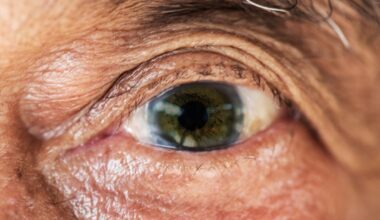 First-of-Its-Kind Treatment Boosts Vision in Human Trial, Scientists Report : ScienceAlert