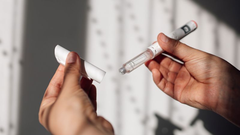 Why some people lose their hair when they’re on GLP-1s