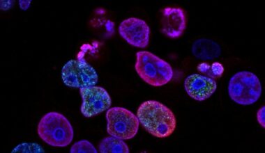 INCan Increases Cancer Care Capacity as It Celebrates 79 Years