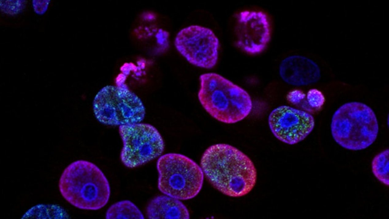 INCan Increases Cancer Care Capacity as It Celebrates 79 Years