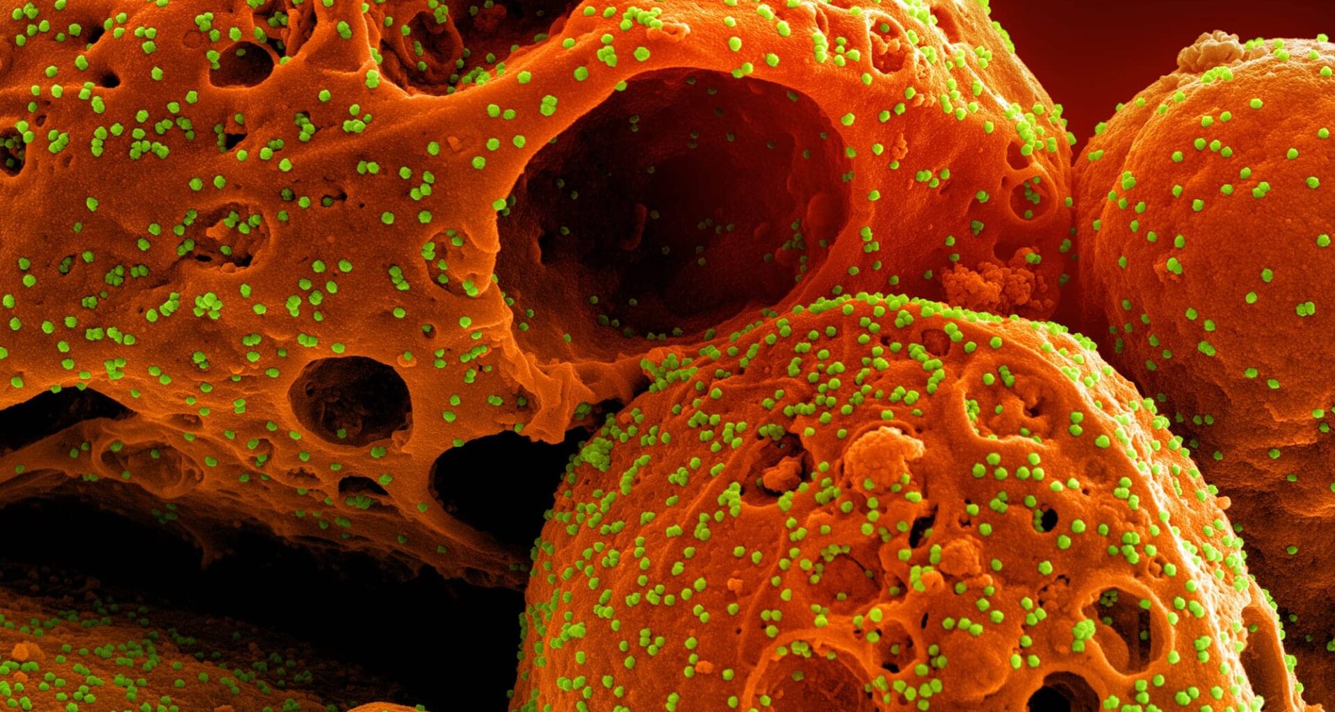 How COVID-19 Variants Evade Immune System