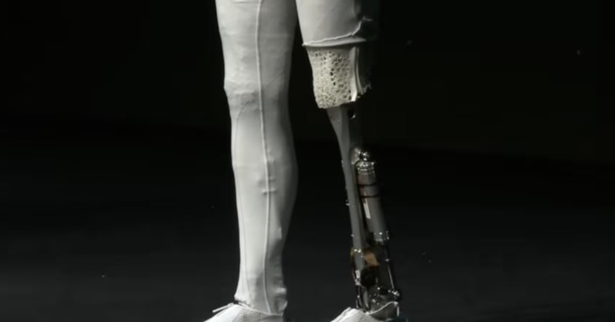 Xpeng cuts open its humanoid robot to prove it's real