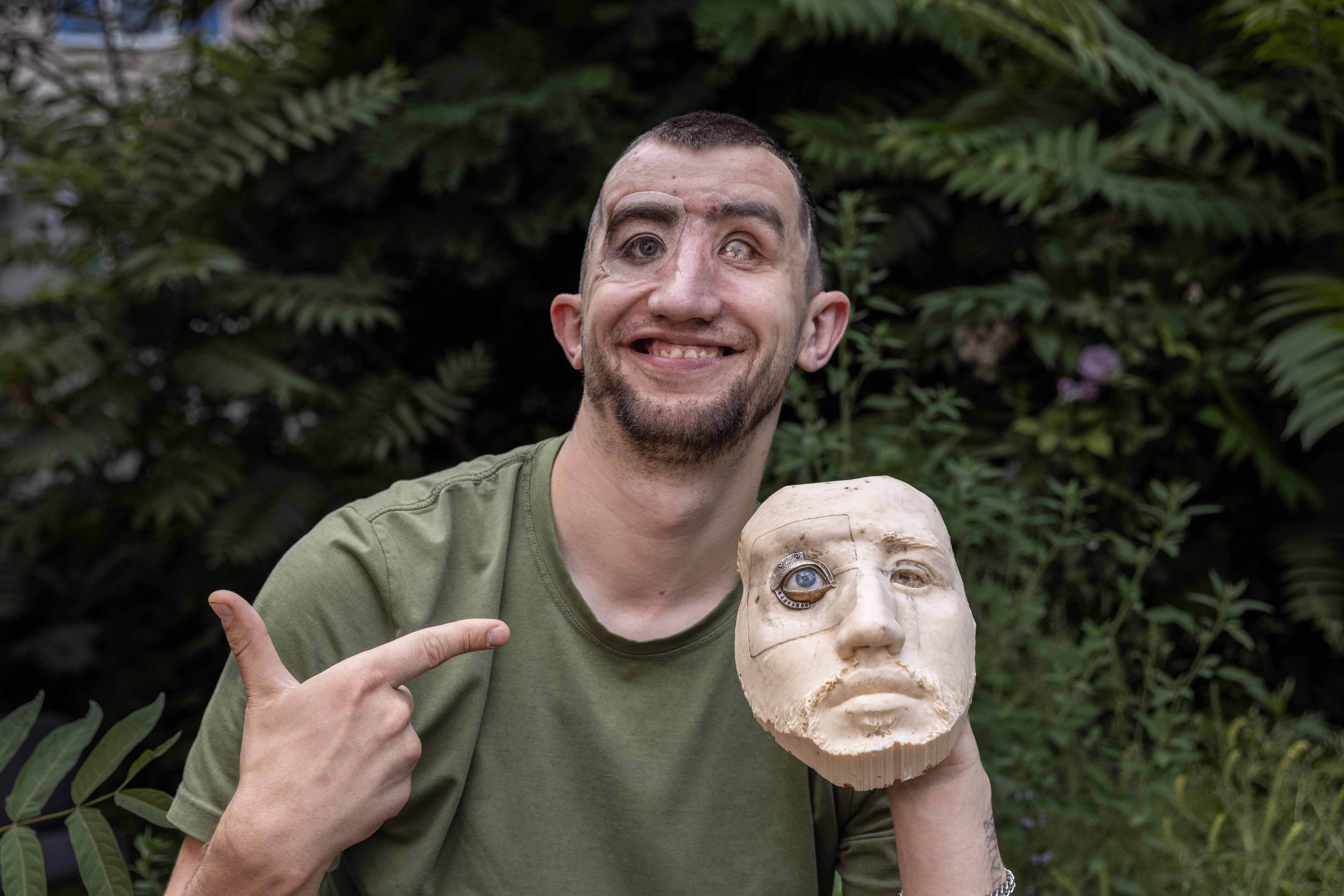 Andrii Onopriienko holding a facial prosthetic that replaces his injured eye.