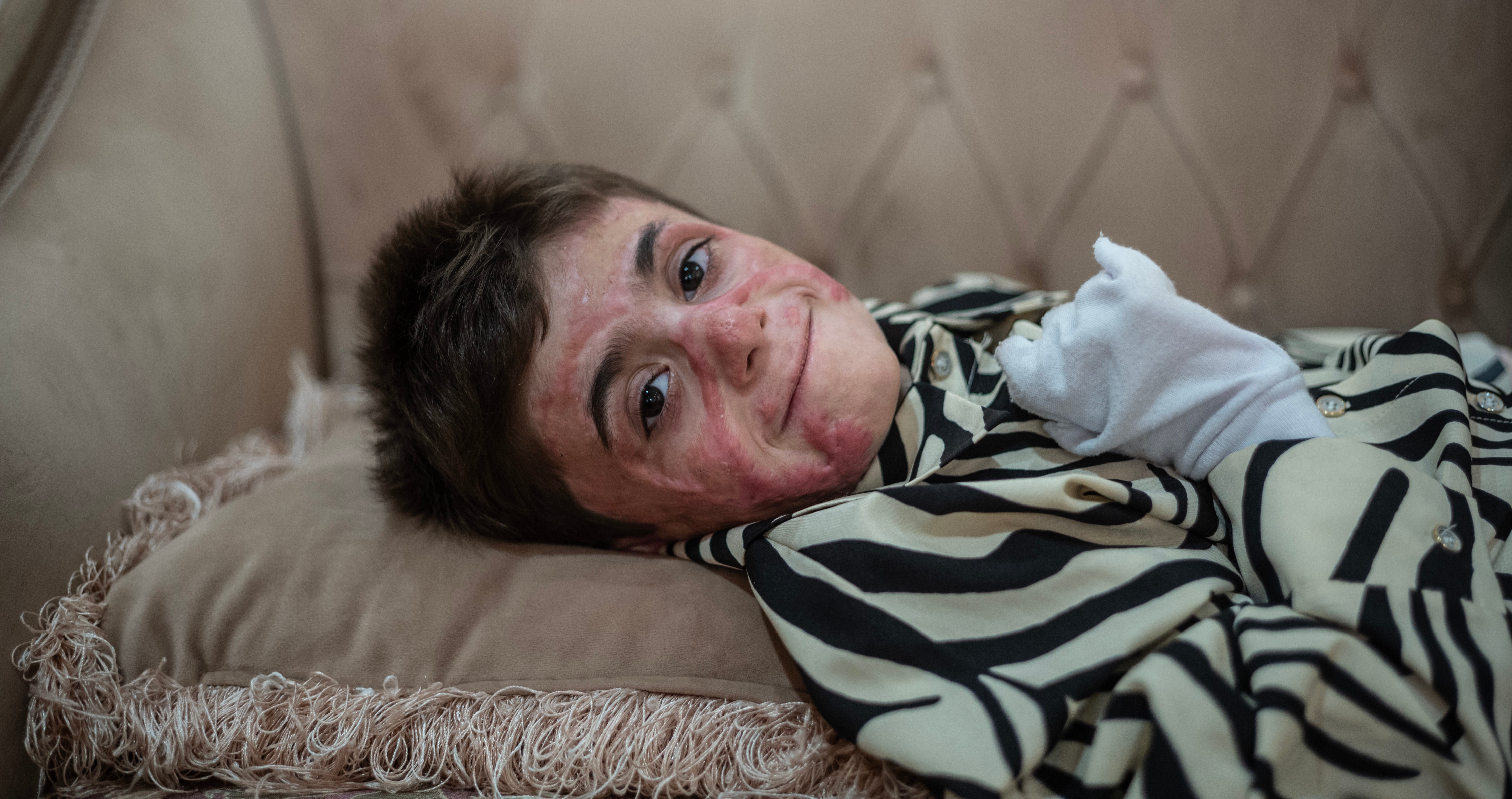 Kian Ghasemian with facial injuries from an Israeli strike.