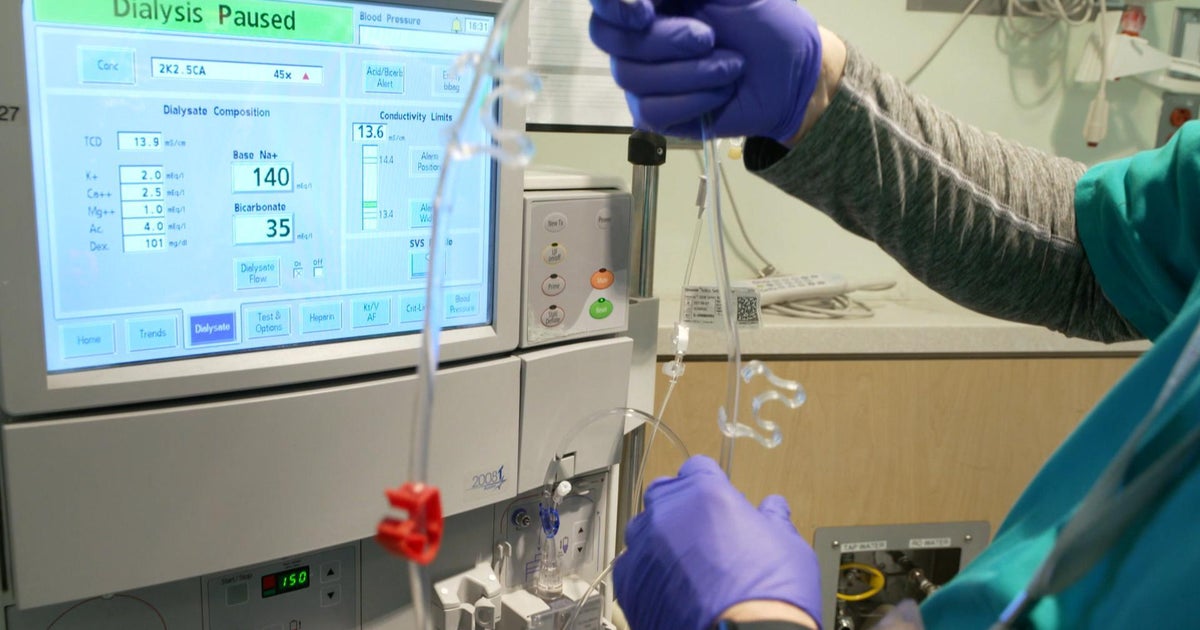 Lawmaker asks what happened to federal investigation into "predatory" for-profit dialysis industry