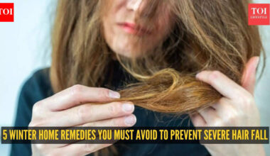 5 common home remedies you must skip in the winter season to stop hairfall
