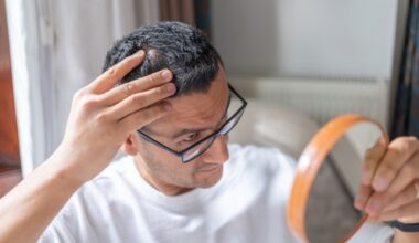 New hair loss treatment shows significant improvement over placebo