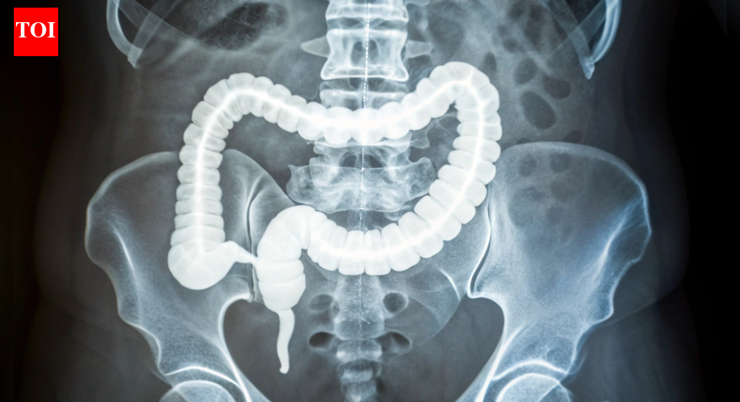 Colorectal Cancer: Why a stiffer colon is raising alarms as colorectal cancer appears earlier: How to identify it |