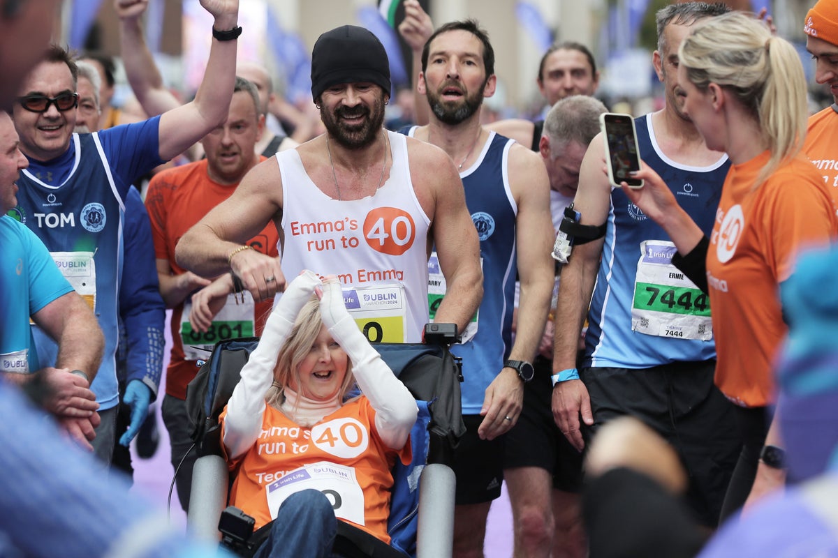 Emma Fogarty discuss friendship with Colin Farrell and her rare genetic disorder