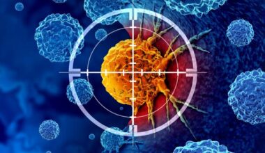 NIH-led study reveals role of mobile DNA elements in lung cancer progression