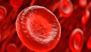 Expanded umbilical cord blood transplant achieves 94% survival in severe aplastic anemia patients