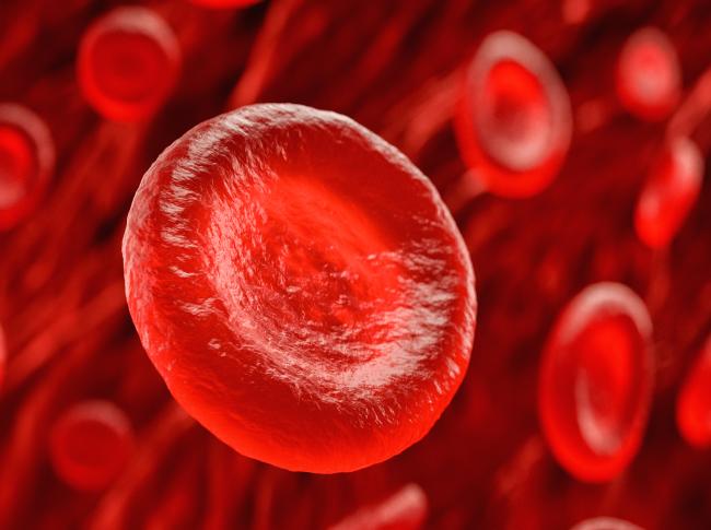 Expanded umbilical cord blood transplant achieves 94% survival in severe aplastic anemia patients