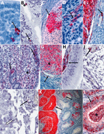 Detection of viral antigens and RNA by immunohistochemistry (IHC) and in situ hybridization (ISH) in reproductive tissues from strain 13/N guinea pigs serially euthanized 4–16 dpi after LASV strain Josiah infection in study of guinea pig model for infection of reproductive tract and considerations for sexual and vertical transmission. IHC and ISH chromogens are red. Panels A–G depict samples from female guinea pigs; panels H–L depict samples from male guinea pigs. A) Uterus (4 dpi), ISH. Rare staining in the endometrial stroma (arrow), without inflammation. B) Endocervix (4 dpi), ISH. Staining of the apical surface of an endocervical epithelial cell (asterisk) and beneath the basilar epithelium (arrow), without inflammation. C) Ovary (8 dpi), IHC. Staining in granulosa lutein cells (arrow) of a corpus luteum without inflammation. D) Uterus (8dpi), IHC. Staining in endometrial stromal cells (arrow) without inflammation. E) Ovary (12 dpi), ISH. Staining in theca interstitial cells (asterisk) and endothelium (arrow). F) Uterus (12 dpi), IHC. Endometrial stromal lymphoplasmacytic infiltrates and staining in endometrial stromal (asterisk) and epithelial (arrows) cells. G) Ovary (16 dpi), IHC. Staining in granulosa cells (asterisk) and endothelium (arrow). H) Epididymis (8 dpi), IHC. Staining in peritubular interstitial mesenchymal cells (arrow). I) Seminal vesicle (12 dpi), ISH. Staining in the wall of a small interstitial vessel (arrow). J) Testis (12 dpi), ISH. Rare granular staining of viral RNA in the interstitium (white arrow) and in a vascular lumen (arrow). K, L) Epididymis (16 dpi), ISH. Extensive staining in tubular epithelium (arrows) and within tubular lumens, including spermatozoa (asterisk). Original magnifications ×40 (panels A, C, D, F, G, H, J, L), ×63 (panels B, I), ×10 (panel E), ×4 (panel K).
