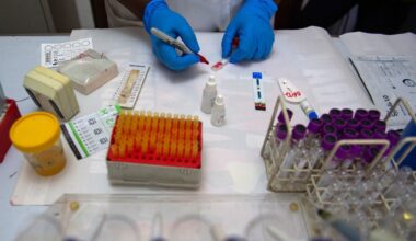 HIV killed 559 Nepalis and infected 614 last year