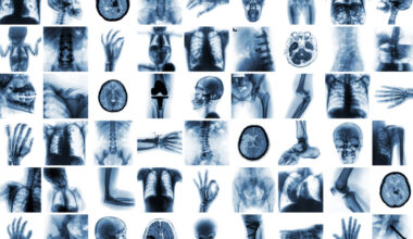 Cognita CEO on next steps for vision language models in radiology