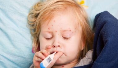 Oakland Co. warns of measles exposure at Commerce Twp. emergency room