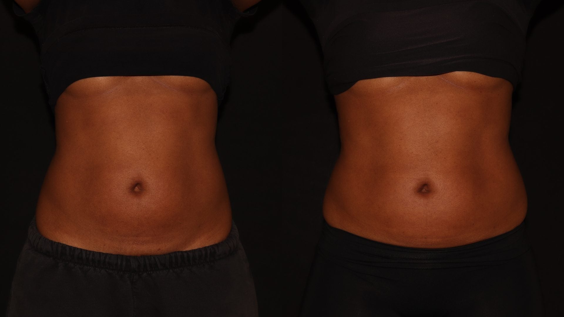 Too Lazy To Workout? Here’s How I Sculpted My Belly By Doing Nothing
