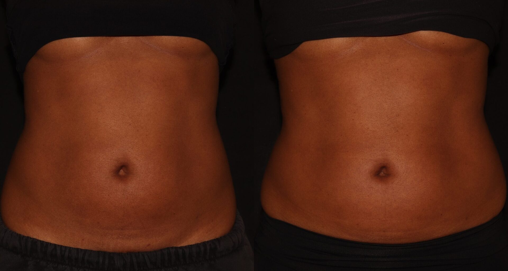 Too Lazy To Workout? Here’s How I Sculpted My Belly By Doing Nothing - Essence