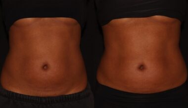 Too Lazy To Workout? Here’s How I Sculpted My Belly By Doing Nothing - Essence