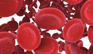 Intravenous iron shows safe and beneficial outcomes for patients with bacterial infection and anemia