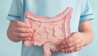 Colon cancer rates are spiking among young people. Here’s why, and how to lower your risk