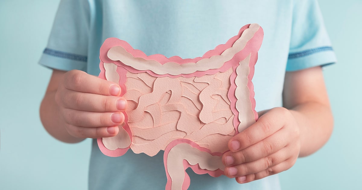 Colon cancer rates are spiking among young people. Here’s why, and how to lower your risk