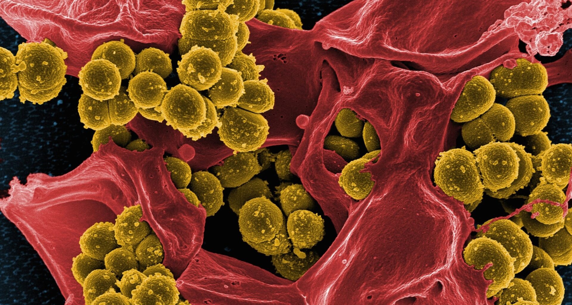 methicillin-resistant Staphylococcus aureus (MRSA) bacteria